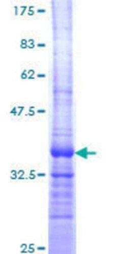 Novus Biologicals Recombinant Human ARFRP1 GST (N-Term) Protein 25 &mu;g | Buy Online | Novus Biologicals&trade; | Fisher Scientific