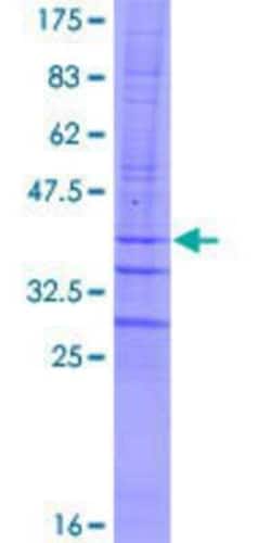 Novus Biologicals Recombinant Human AC1 GST (N-Term) Protein 10 &mu;g | Buy Online | Novus Biologicals&trade; | Fisher Scientific