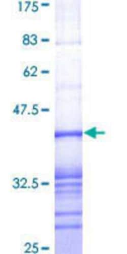 Novus Biologicals Recombinant Human AKAP9 GST (N-Term) Protein 25 &mu;g | Buy Online | Novus Biologicals&trade; | Fisher Scientific