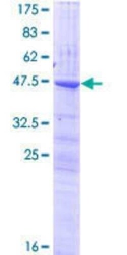 Novus Biologicals Recombinant Human CLEC3A GST (N-Term) Protein 25 &mu;g | Buy Online | Novus Biologicals&trade; | Fisher Scientific