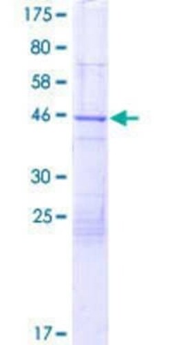 Novus Biologicals Recombinant Human FAM13A GST (N-Term) Protein 2 &mu;g | Buy Online | Novus Biologicals&trade; | Fisher Scientific