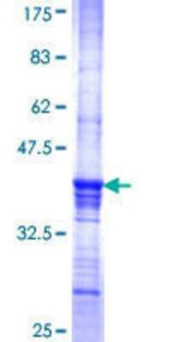 Novus Biologicals Recombinant Human SFRS14 GST (N-Term) Protein 25 &mu;g | Buy Online | Novus Biologicals&trade; | Fisher Scientific