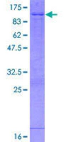 Novus Biologicals Recombinant Human ABI2 GST (N-Term) Protein 2 &mu;g | Buy Online | Novus Biologicals&trade; | Fisher Scientific