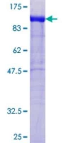 Novus Biologicals Recombinant Human WASF2 GST (N-Term) Protein 10 &mu;g | Buy Online | Novus Biologicals&trade; | Fisher Scientific