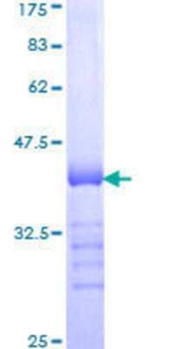 Novus Biologicals Recombinant Human WASF2 GST (N-Term) Protein 10 &mu;g | Buy Online | Novus Biologicals&trade; | Fisher Scientific
