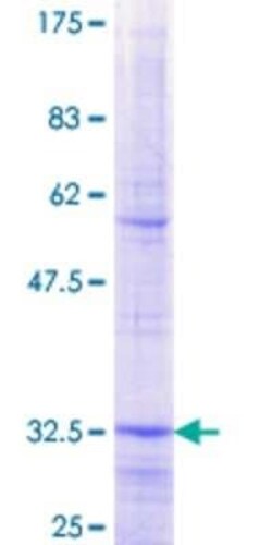 Novus Biologicals Recombinant Human SLC25A15 GST (N-Term) Protein 2 &mu;g | Buy Online | Novus Biologicals&trade; | Fisher Scientific