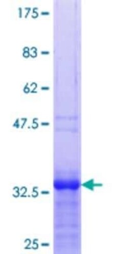 Novus Biologicals Recombinant Human ZNF256 GST (N-Term) Protein 25 &mu;g | Buy Online | Novus Biologicals&trade; | Fisher Scientific
