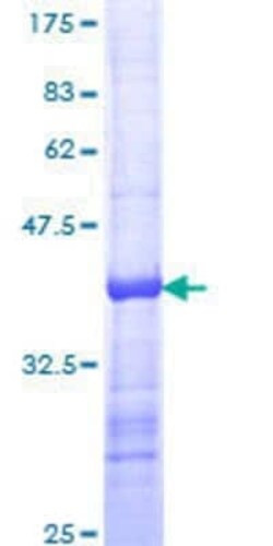 Novus Biologicals Recombinant Human Teneurin-1 GST (N-Term) Protein 10 &mu;g | Buy Online | Novus Biologicals&trade; | Fisher Scientific