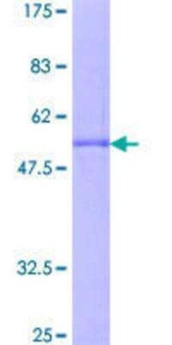 Novus Biologicals Recombinant Human RBM7 GST (N-Term) Protein 2 &mu;g | Buy Online | Novus Biologicals&trade; | Fisher Scientific