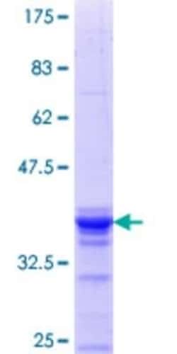 Novus Biologicals Recombinant Human RBM6 GST (N-Term) Protein 10 &mu;g | Buy Online | Novus Biologicals&trade; | Fisher Scientific