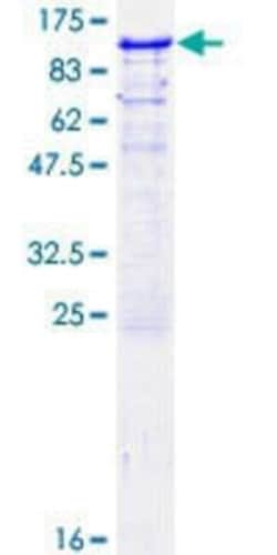 Novus Biologicals Recombinant Human RBM5 GST (N-Term) Protein 10 &mu;g | Buy Online | Novus Biologicals&trade; | Fisher Scientific