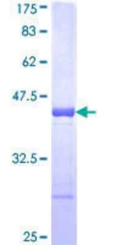 Novus Biologicals Recombinant Human RBM5 GST (N-Term) Protein 10 &mu;g | Buy Online | Novus Biologicals&trade; | Fisher Scientific