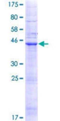 Novus Biologicals Recombinant Human LHFP GST (N-Term) Protein 10 &mu;g | Buy Online | Novus Biologicals&trade; | Fisher Scientific