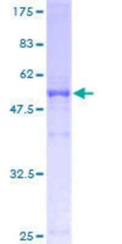Novus Biologicals Recombinant Human TXNDC9 GST (N-Term) Protein 10 &mu;g | Buy Online | Novus Biologicals&trade; | Fisher Scientific