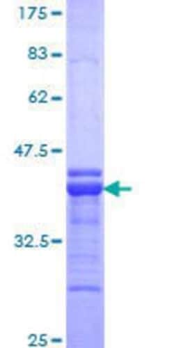 Novus Biologicals Recombinant Human Teashirt homolog 1 GST (N-Term) Protein 25 &mu;g | Buy Online | Novus Biologicals&trade; | Fisher Scientific