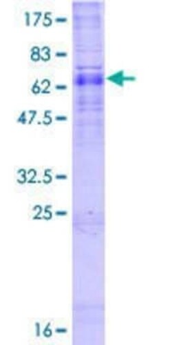 Novus Biologicals Recombinant Human ALG3 GST (N-Term) Protein 2 &mu;g | Buy Online | Novus Biologicals&trade; | Fisher Scientific