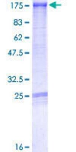 Novus Biologicals Recombinant Human MPHOSPH9- GST (N-Term) Protein 25 &mu;g | Buy Online | Novus Biologicals&trade; | Fisher Scientific