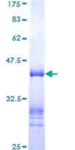 Novus Biologicals Recombinant Human MPHOSPH9- GST (N-Term) Protein 10 &mu;g | Buy Online | Novus Biologicals&trade; | Fisher Scientific