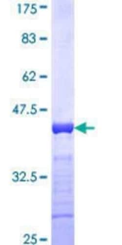 Novus Biologicals Recombinant Human MPHOSPH10 GST (N-Term) Protein 10 &mu;g | Buy Online | Novus Biologicals&trade; | Fisher Scientific