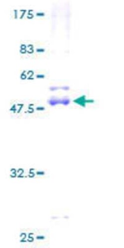 Novus Biologicals Recombinant Human NME6 GST (N-Term) Protein 2 &mu;g | Buy Online | Novus Biologicals&trade; | Fisher Scientific