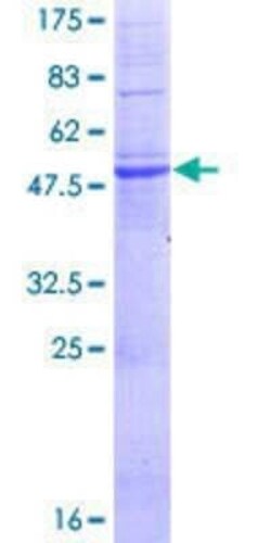 Novus Biologicals Recombinant Human EVA1/MPZL2 GST (N-Term) Protein 2 &mu;g | Buy Online | Novus Biologicals&trade; | Fisher Scientific