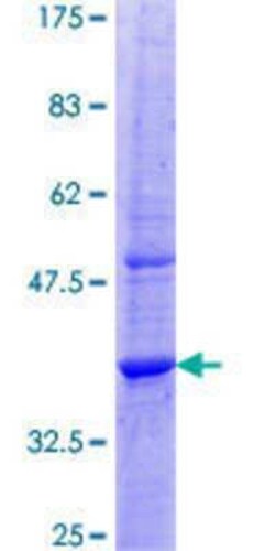 Novus Biologicals Recombinant Human EVA1/MPZL2 GST (N-Term) Protein 25 &mu;g | Buy Online | Novus Biologicals&trade; | Fisher Scientific