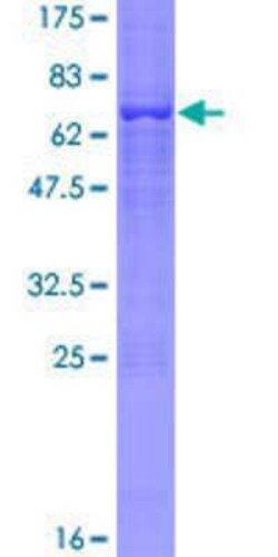 Novus Biologicals Recombinant Human TRIM13 GST (N-Term) Protein 10 &mu;g | Buy Online | Novus Biologicals&trade; | Fisher Scientific