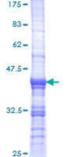 Novus Biologicals Recombinant Human PATJ GST (N-Term) Protein 25 &mu;g | Buy Online | Novus Biologicals&trade; | Fisher Scientific