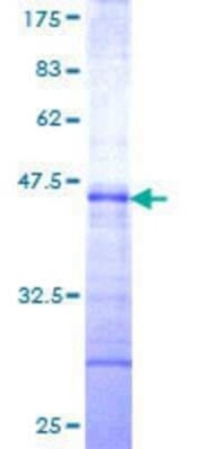 Novus Biologicals Recombinant Human USPL1 GST (N-Term) Protein 25 &mu;g | Buy Online | Novus Biologicals&trade; | Fisher Scientific