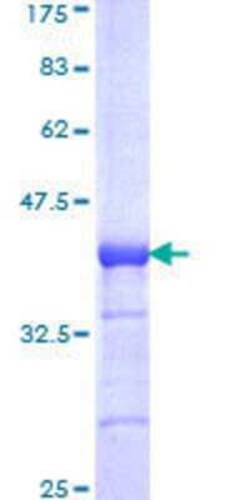 Novus Biologicals Recombinant Human TOPORS GST (N-Term) Protein 25 &mu;g | Buy Online | Novus Biologicals&trade; | Fisher Scientific