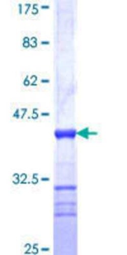 Novus Biologicals Recombinant Human SSX3 GST (N-Term) Protein 10 &mu;g | Buy Online | Novus Biologicals&trade; | Fisher Scientific