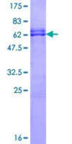 Novus Biologicals Recombinant Human Olig2 GST (N-Term) Protein 10 &mu;g | Buy Online | Novus Biologicals&trade; | Fisher Scientific