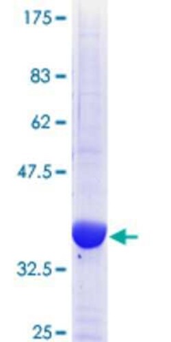 Novus Biologicals Recombinant Human TRIB1 GST (N-Term) Protein 10 &mu;g | Buy Online | Novus Biologicals&trade; | Fisher Scientific