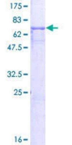 Novus Biologicals Recombinant Human A33/GPA33 GST (N-Term) Protein 25 &mu;g | Buy Online | Novus Biologicals&trade; | Fisher Scientific