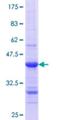 Novus Biologicals Recombinant Human A33/GPA33 GST (N-Term) Protein 25 &mu;g | Buy Online | Novus Biologicals&trade; | Fisher Scientific