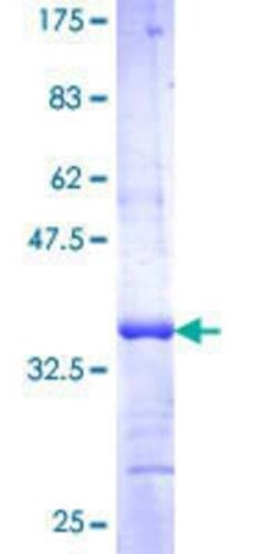 Novus Biologicals Recombinant Human NBR2 GST (N-Term) Protein 25 &mu;g | Buy Online | Novus Biologicals&trade; | Fisher Scientific