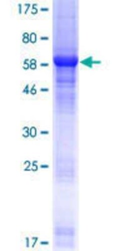 Novus Biologicals Recombinant Human LRRC23 GST (N-Term) Protein 10 &mu;g | Buy Online | Novus Biologicals&trade; | Fisher Scientific