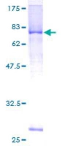 Novus Biologicals Recombinant Human LRRC17 GST (N-Term) Protein 2 &mu;g | Buy Online | Novus Biologicals&trade; | Fisher Scientific