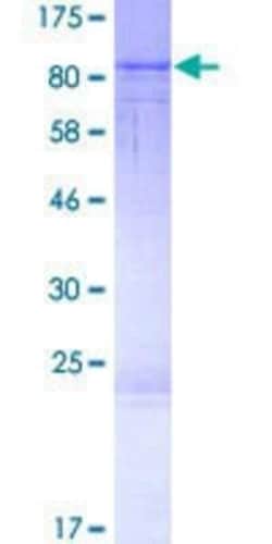 Novus Biologicals Recombinant Human RASGRP2 GST (N-Term) Protein 2 &mu;g | Buy Online | Novus Biologicals&trade; | Fisher Scientific