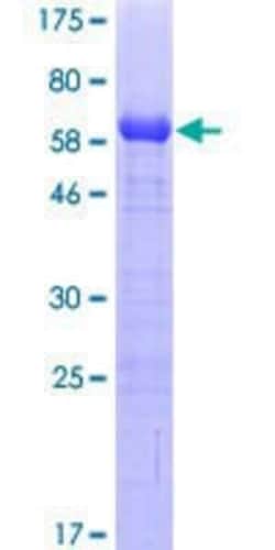 Novus Biologicals Recombinant Human RASGRP2 GST (N-Term) Protein 10 &mu;g | Buy Online | Novus Biologicals&trade; | Fisher Scientific