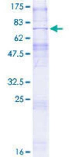 Novus Biologicals Recombinant Human SLC35B1 GST (N-Term) Protein 2 &mu;g | Buy Online | Novus Biologicals&trade; | Fisher Scientific