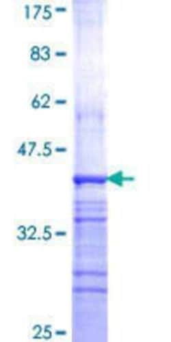 Novus Biologicals Recombinant Human AP3S2 GST (N-Term) Protein 25 &mu;g | Buy Online | Novus Biologicals&trade; | Fisher Scientific