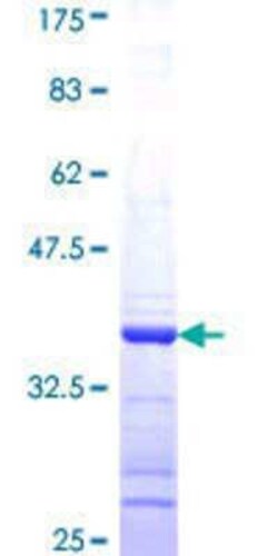Novus Biologicals Recombinant Human Gephyrin/GPHN GST (N-Term) Protein 25 &mu;g | Buy Online | Novus Biologicals&trade; | Fisher Scientific