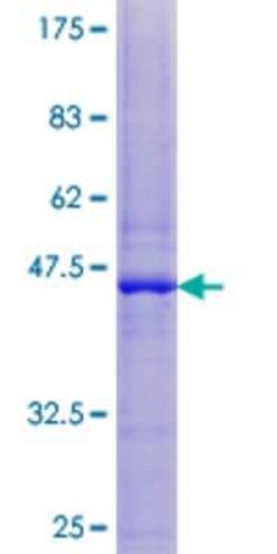 Novus Biologicals Recombinant Human TIMM17B GST (N-Term) Protein 10 &mu;g | Buy Online | Novus Biologicals&trade; | Fisher Scientific