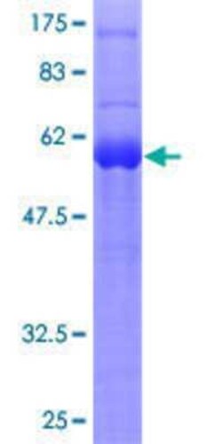 Novus Biologicals Recombinant Human SPRY1 GST (N-Term) Protein 10 &mu;g | Buy Online | Novus Biologicals&trade; | Fisher Scientific