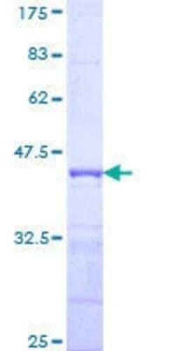 Novus Biologicals Recombinant Human SPRY1 GST (N-Term) Protein 10 &mu;g | Buy Online | Novus Biologicals&trade; | Fisher Scientific