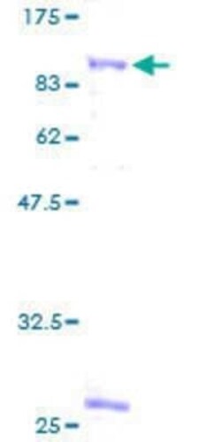 Novus Biologicals Recombinant Human STAM2 GST (N-Term) Protein 10 &mu;g | Buy Online | Novus Biologicals&trade; | Fisher Scientific