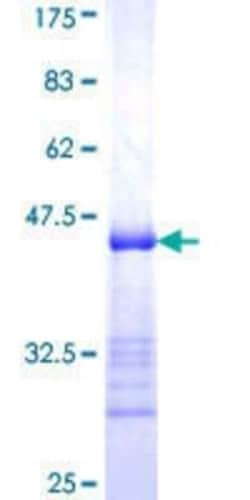 Novus Biologicals Recombinant Human STAM2 GST (N-Term) Protein 10 &mu;g | Buy Online | Novus Biologicals&trade; | Fisher Scientific