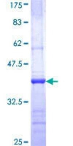 Novus Biologicals Recombinant Human CNKSR1 GST (N-Term) Protein 25 &mu;g | Buy Online | Novus Biologicals&trade; | Fisher Scientific