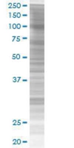 Novus Biologicals CNKSR1 293T Cell Transient Overexpression Lysate 0.1 mL | Buy Online | Novus Biologicals&trade; | Fisher Scientific